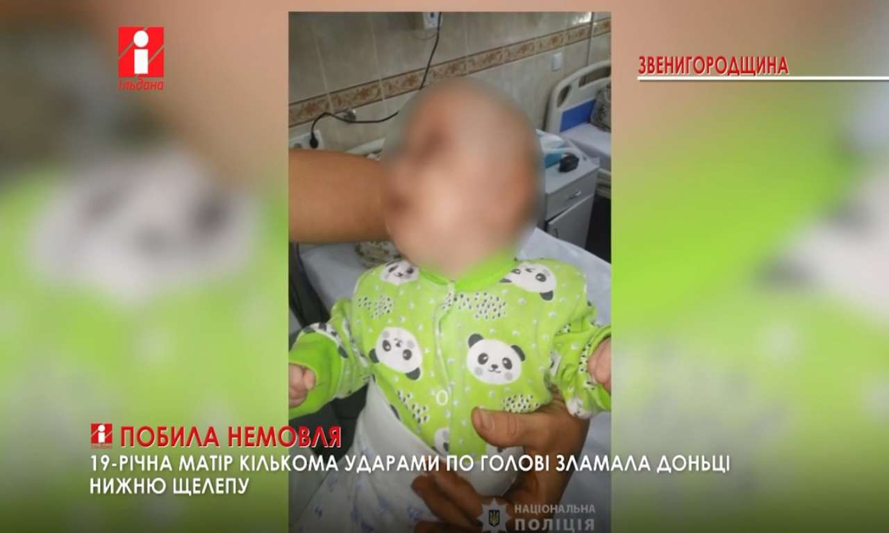 На Звенигородщині 19-річна матір кількома ударами по голові зламала доньці нижню щелепу (ВІДЕО)